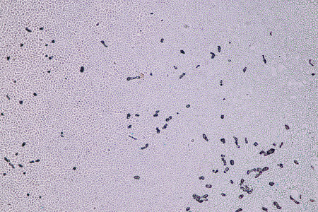 Host cells with spores (mold) are inside wood under the microscope for education.