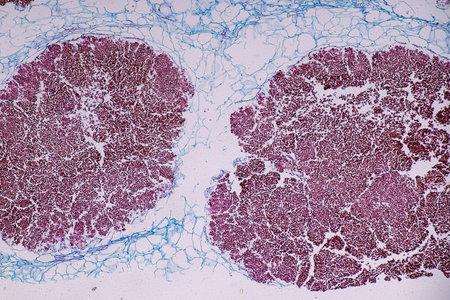 Host cells with spores (mold) are inside wood under the microscope for education.