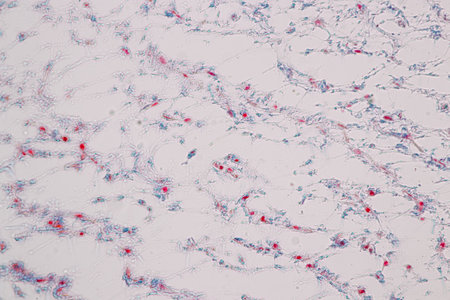 Histological Uterus human, Uterine tube human, Placenta human and Umbilical cord Human under the...