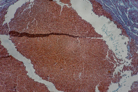 Histological Uterus human, Uterine tube human, Placenta human and Umbilical cord Human under the...