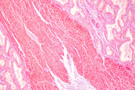 Histological Spermatic cord human, Seminal vesicle human, Prostate human and Human chromosomes under...