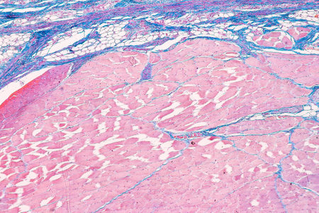 Anatomy and Histological Bone, Elastic cartilage human and Joint of human foetus under the...