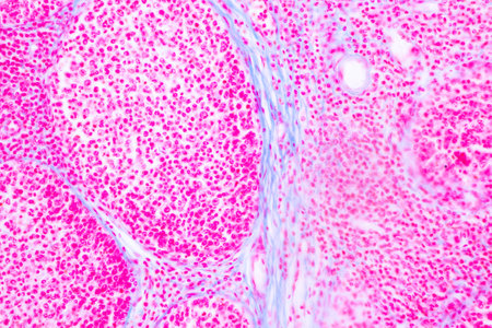 Anatomy and Histological Bone, Elastic cartilage human and Joint of human foetus under the...