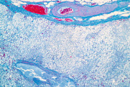 Showing Light micrograph of the Adrenal gland and Urinary bladder human under the microscope for education in the laboratory.の写真素材