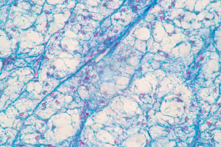 Showing Light micrograph of the Adrenal gland and Urinary bladder human under the microscope for...