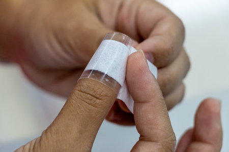 Injured fingers, nails torn, bruised and A nail will fall off,  causing pain and requiring medical...