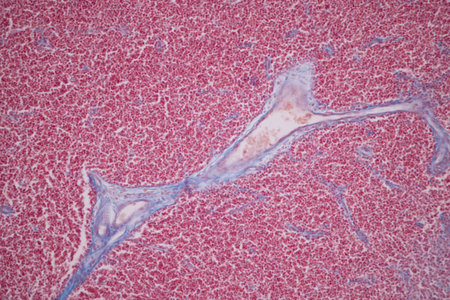 Showing Light micrograph of the Thyroid gland and Thymus gland human Child under the microscope for...