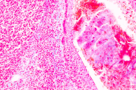 Showing Light micrograph of the Trachea, Thymus, Parathyroid gland and Tonsil  human under the...