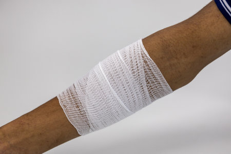 Closeup injured at leg and hand, Fresh wounds from accident.