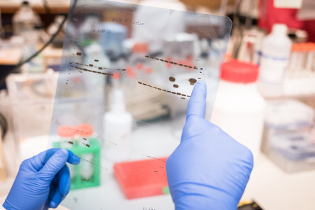 Researcher working on Western Blot results