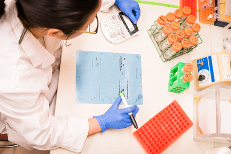 Researcher working on Western Blot results
