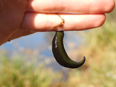 Human hand with a leechの写真素材