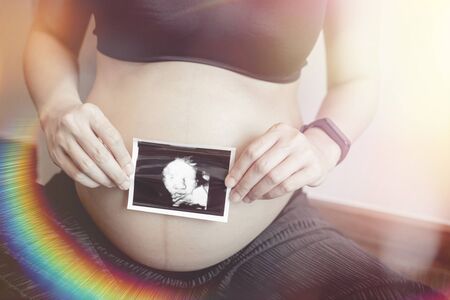 An Asian woman holding an ultrasound image of a child waiting for the baby's birthday. Selective...