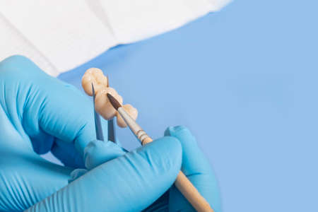 medical equipment. Making a denture. The doctor holds a crown in his hands and covers it with a special compoundの写真素材