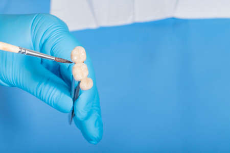 medical equipment. Making a denture. The doctor holds a crown in his hands and covers it with a...