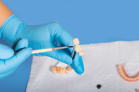 medical equipment. Making a denture. The doctor holds a crown in his hands and covers it with a...