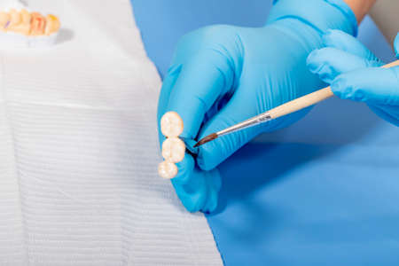 medical equipment. Making a denture. The doctor holds a crown in his hands and covers it with a special compoundの写真素材