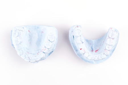 teeth mold on isolated white backgroundの写真素材