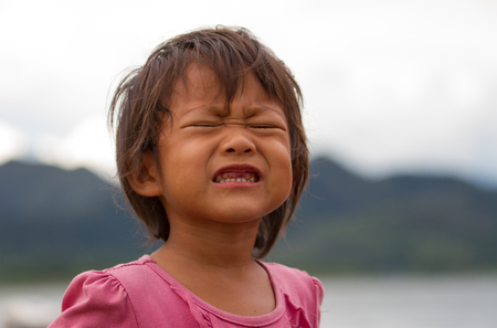 Close up baby teeth with caries, decayed toothの写真素材