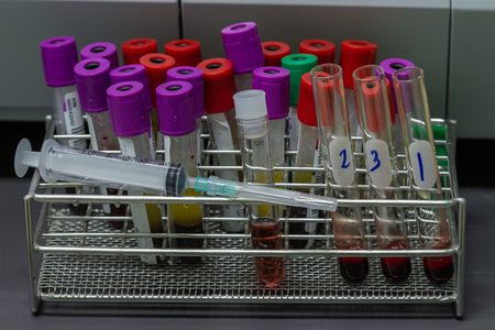 Closeup test tubes with blood for medical and biological analyzes, medicine equipment and health conceptの写真素材