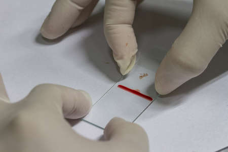doctor will put a drop of blood on the sterile slide, medicine equipment and health conceptの写真素材