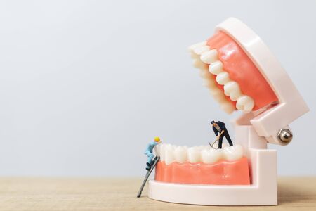 Miniature people : Worker team repairing a tooth ,Healthcare and medical conceptの写真素材