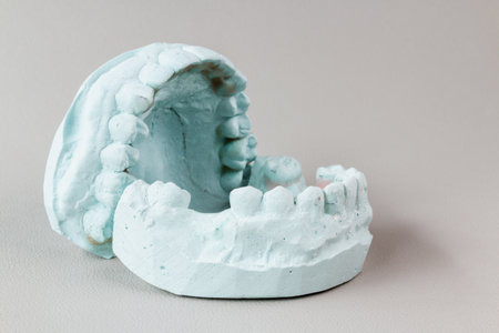 A dental plaster model showcasing the upper and lower rows of teeth, often used for dental studies or moldsの写真素材