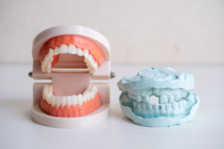 A side-by-side comparison of a plastic dental model and a blue plaster cast of human teeth