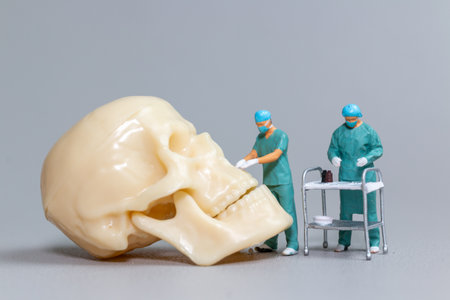 Tiny toy doctors in scrubs perform a delicate and precise surgery on a large human skull model, symbolizing complex medical procedures and teamwork.の写真素材