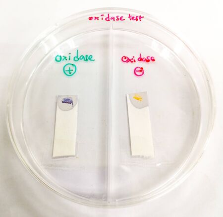 oxidase testの写真素材