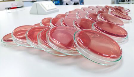 MacConkey agarの写真素材