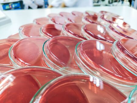 MacConkey agarの写真素材