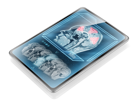 Brain activity scan displayed on tabletの写真素材