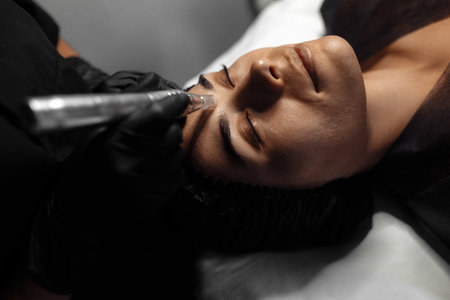 Cosmetologist make procedure for cleaning skin with steel tool from blackheads and acneの写真素材