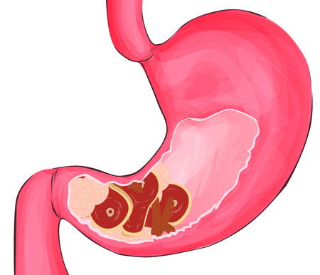Meat in human stomach. diet, health food - vector illustrationのイラスト素材