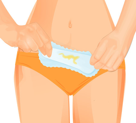 vector illustration of a vaginal discharge On Sanitary Padのイラスト素材