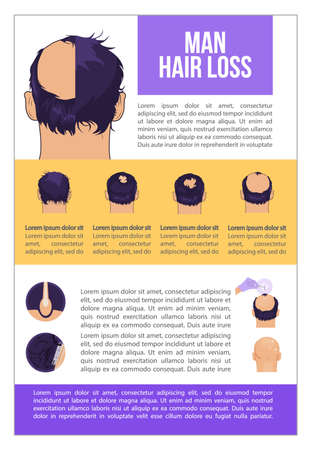 Man hairloss problem flat illustration Baldness stagesのイラスト素材