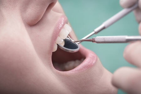 Young woman  with perfect teeth and dental instrumentsの写真素材