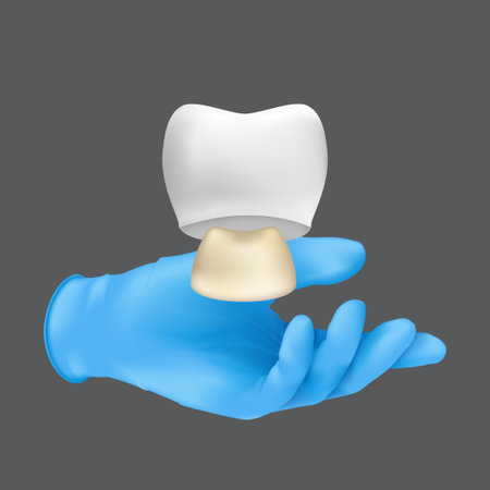 Dentist hand wearing blue protective surgical glove holding a ceramic model of the tooth. 3d realistic vector illustration of a crown on teeth concept isolated on a gray backgroundのイラスト素材