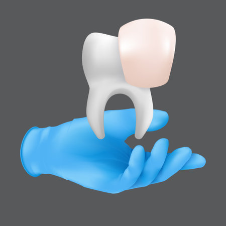 Dentist hand wearing blue protective surgical glove holding a ceramic model of the tooth. 3d realistic vector illustration of porcelain veneers concept isolated on a gray backgroundのイラスト素材