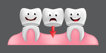 Smiling teeth with fixed bridgework. Cute character with facial expression. Funny icon for children's design. 3d realistic vector illustration of a dental ceramic model isolated on a gray backgroundのイラスト素材