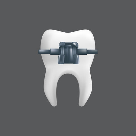 A tooth with a metal brace. Orthodontic treatment concept. 3d realistic vector illustration of a dental ceramic model isolated on a gray backgroundのイラスト素材