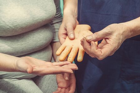 medical doctor performs acupuncture on a patients armの写真素材