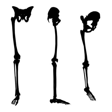 Set with silhouettes of human skeleton of legs and pelvis in different positions isolated on white background. Vector illustrationのイラスト素材