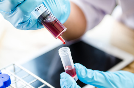 closeup hand of scientist in lab . Hand hold syringe  blood in tube , Testing result  Medical or chemical background の写真素材