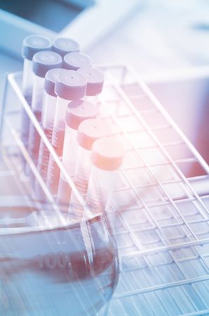 Vacutainer or test tube in lab on table の写真素材