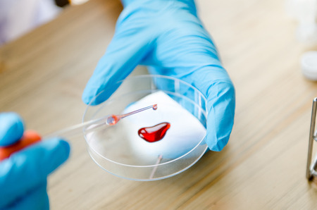 Vacutainer or test tube in lab on table blood on handの写真素材