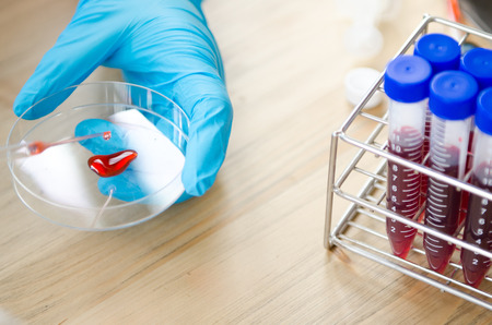 Vacutainer or test tube in lab on tableの写真素材