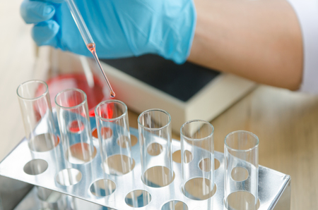 Vacutainer or test tube in lab on tableの写真素材