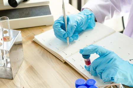 A pipette dropping sample into a test tube,abstract science backgroundの写真素材